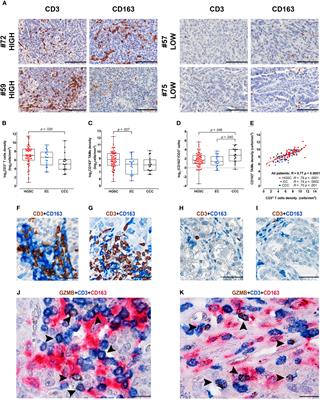 Infiltration by CXCL10 Secreting Macrophages Is Associated With Antitumor Immunity and Response to Therapy in Ovarian Cancer Subtypes